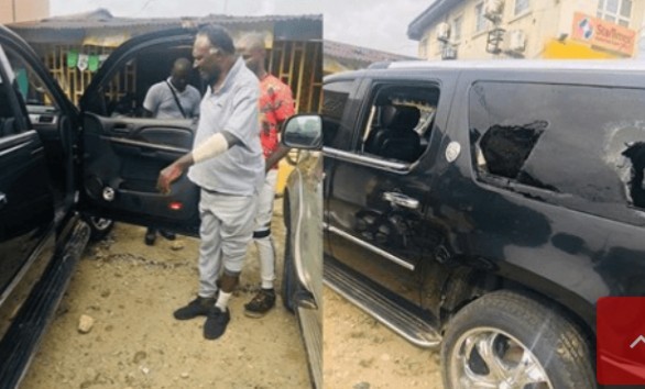 Veteran Actor, Clem Ohameze Attacked By Hoodlums In Uyo (Photos)