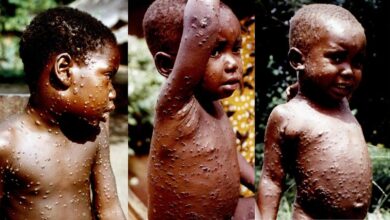 How Humans Can Get Infected with Monkeypox -NCDC