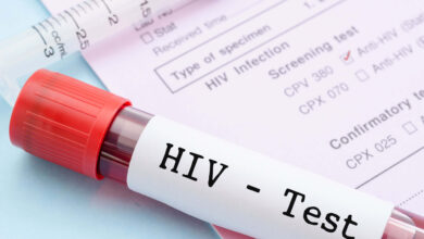5 Benefits of Regular Testing for HIV Prevention